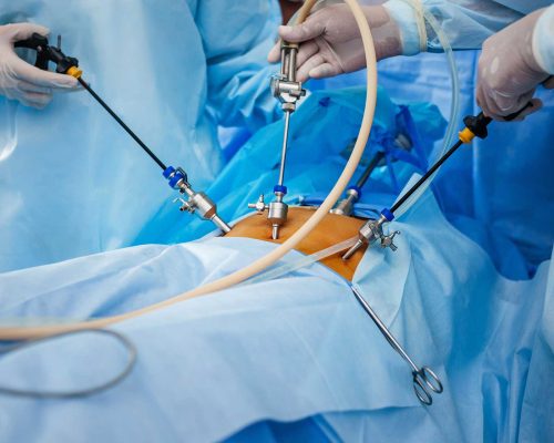 General-and-Laparoscopic-Surgery